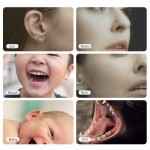 Ωτοσκόπιο OTO-01 5MP Wifi με 6 led για αφαίρεση του κεριού, σύνδεση με Android/Iphone 